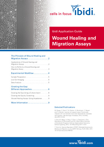 ibidi Application Guide Wound Healing and Migration Assays
