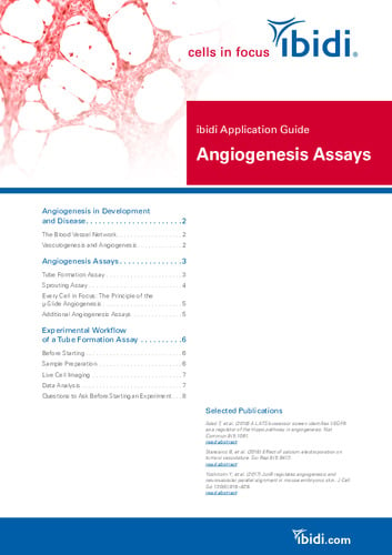 ibidi Application Guide Angiogenesis Assays
